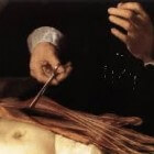 Schilderkunst 17e eeuw: Anatomische les (Rembrandt)
